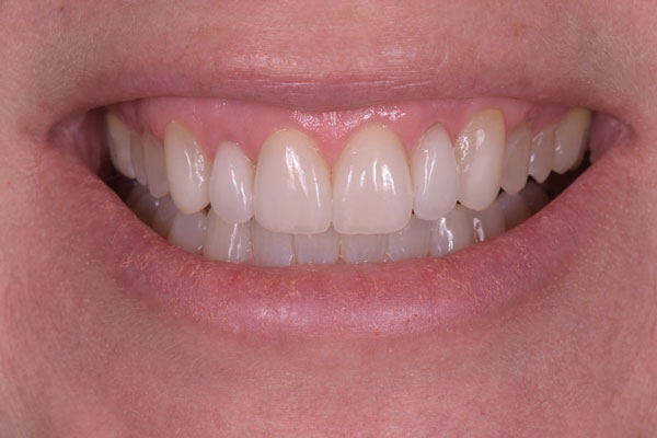 Complex cases in Toronto by Dr. Mario Rotella